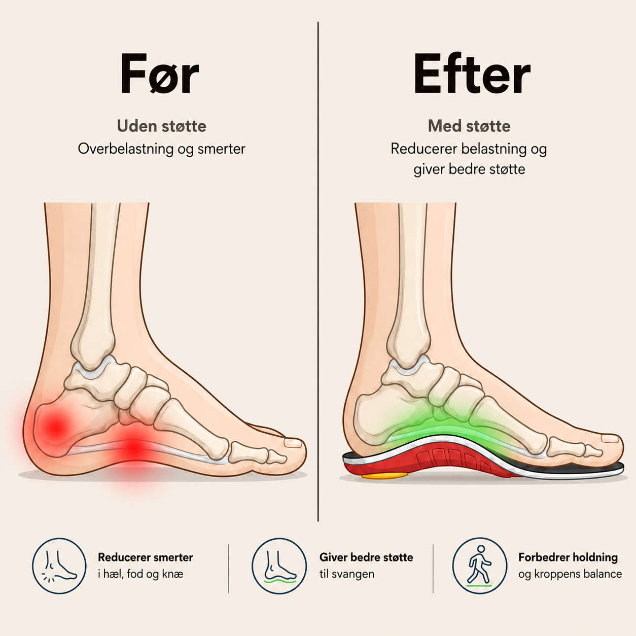 NeedyKnee FlexStep™ – Ortopædiske støttesåler for bedre komfort hele dagen