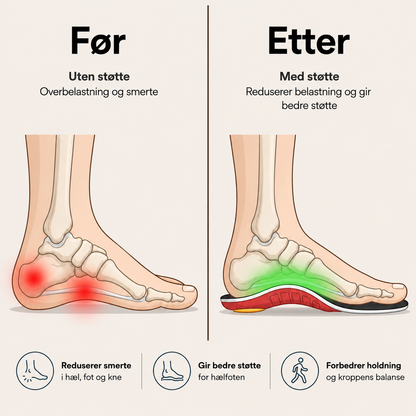 NeedyKnee FlexStep™ – Ortopediske støttesåler for bedre komfort hele dagen
